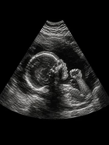 A printed ultrasound photo of a baby in profile, pinned to a clothesline (AI image)